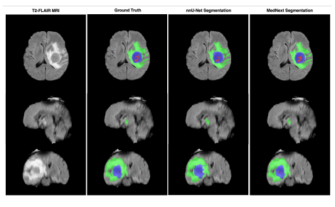 Brain Tumor Segmentation